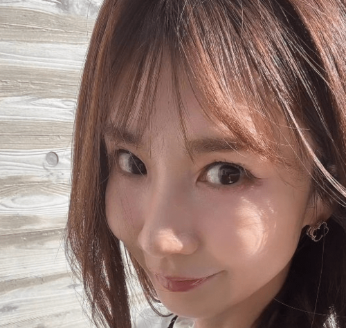 「上品でかわいくて」ほしのあき、キュートな“アヒル口”で美容整形報告に様々な声「元の方が私は好きかな」