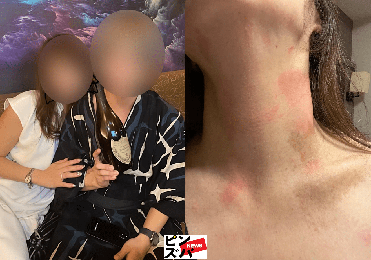 『令和の虎』がオーナーのホスト店で3度の暴力沙汰 被害女性が告白「対応途中で音信普通に……」